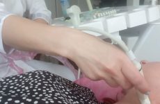 УЗД лімфатичних вузлів