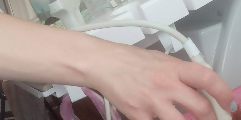 Щитовидка, результати обстеження УЗД щитоподібної залози