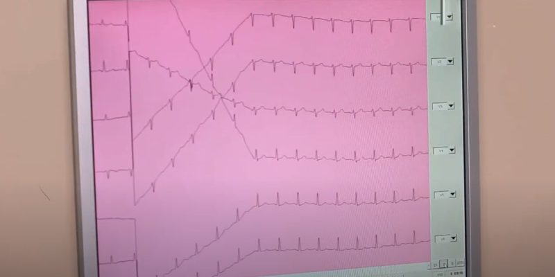 Болить в області серця: тяжкість або болі у лівій частині грудей