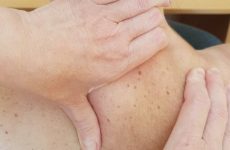 Біль під правою лопаткою