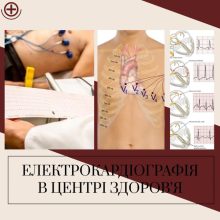 Функціональна діагностика
