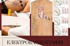 Задишка відчуття нестачі повітря