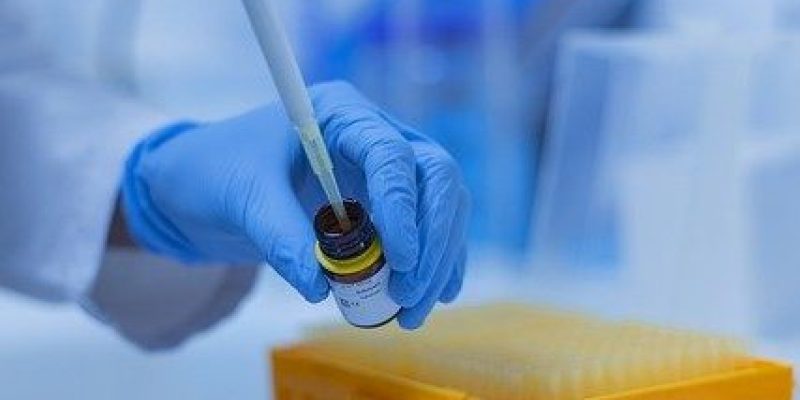 КД лабораторія Центр Здоров’я виконує біохімічний аналіз крові