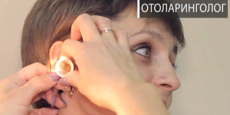 Заклало вухо – сірчана корка.