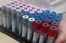 Забір крові на дослідження